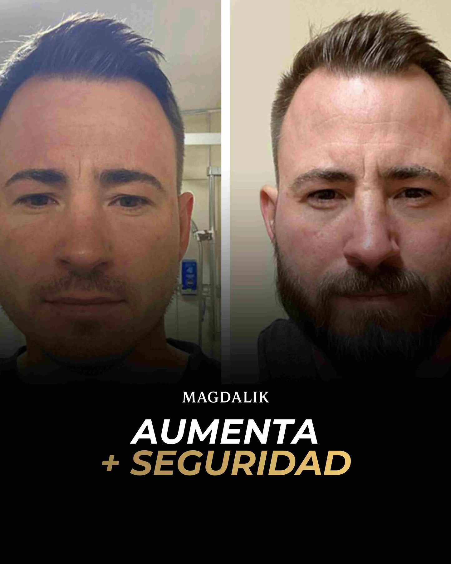 Aceite Capilar Engrosador Pro +