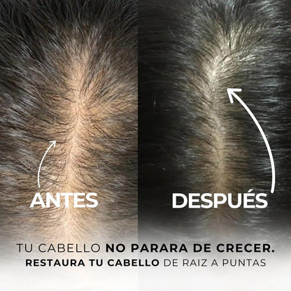 TONICO  BIOESTIMULADOR DE CRECIMIENTO